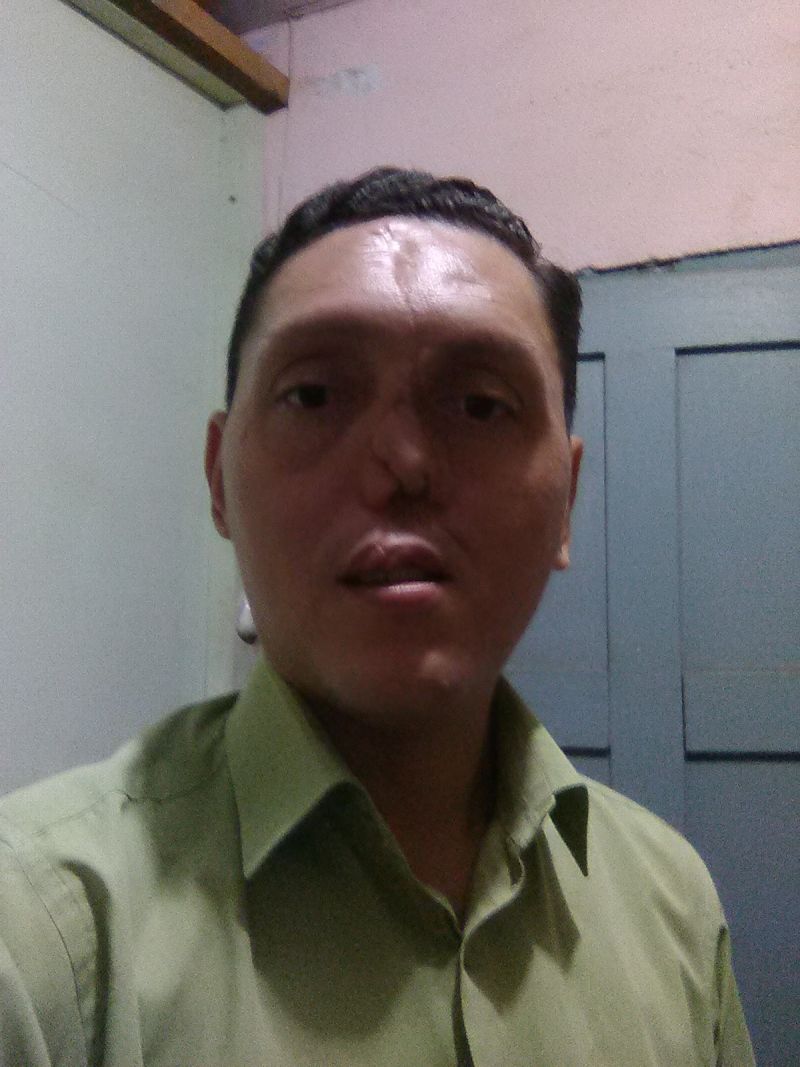 Alberto1980