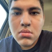 Anthony20